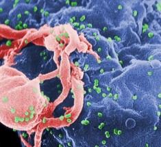 Vaccin contre le SIDA bientôt testé sur l’homme dans un hôpital espagnol