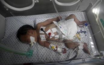 Le bébé miracle de Gaza est finalement décédé!