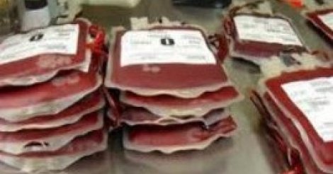 Alerte : Ruptures récurrentes de stock à la banque de sang de l’hôpital de Ziguinchor !