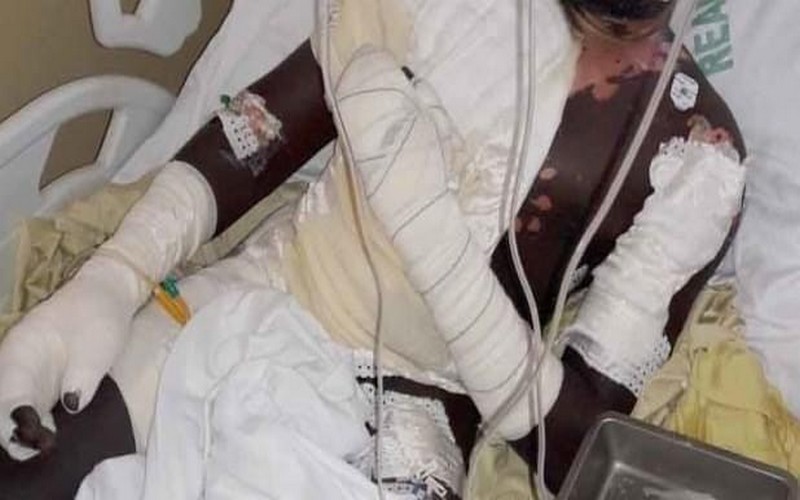 Une dame ébouillante son époux à Touba